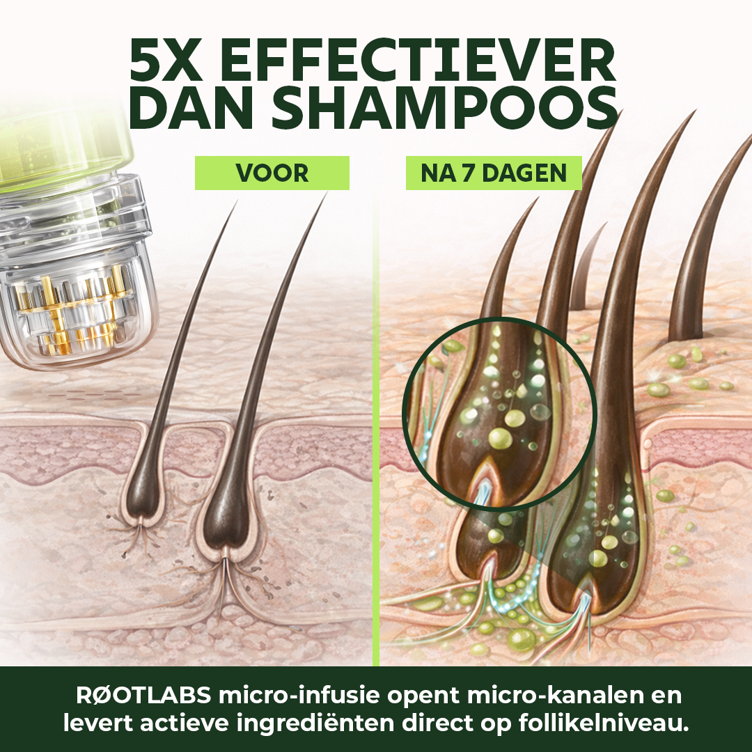 Hair Infusion Kit™