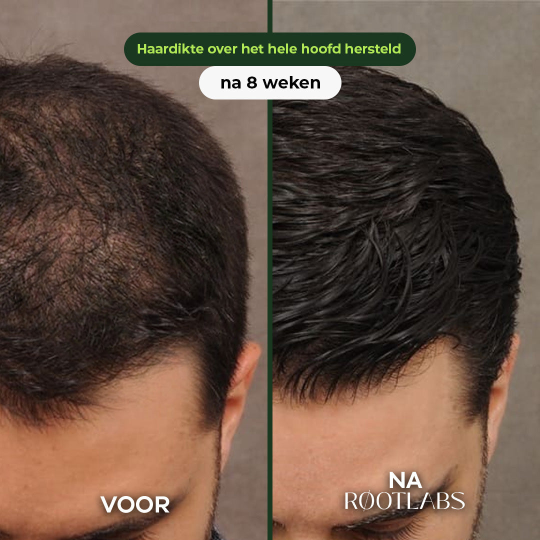 Hair Infusion Kit™