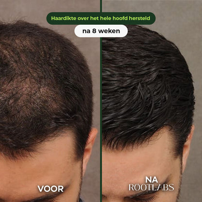 Hair Infusion Kit™