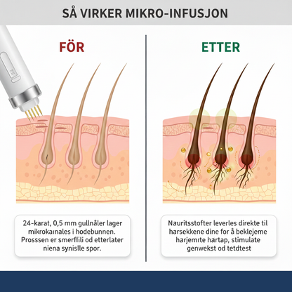 Hair Infusion Kit™ | Natural DHT Blocker