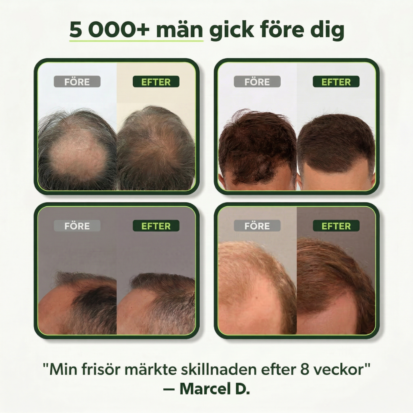 RØOT™ Hair Regrowth System
