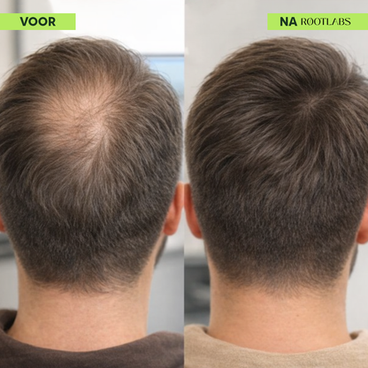 Hair Infusion Kit™